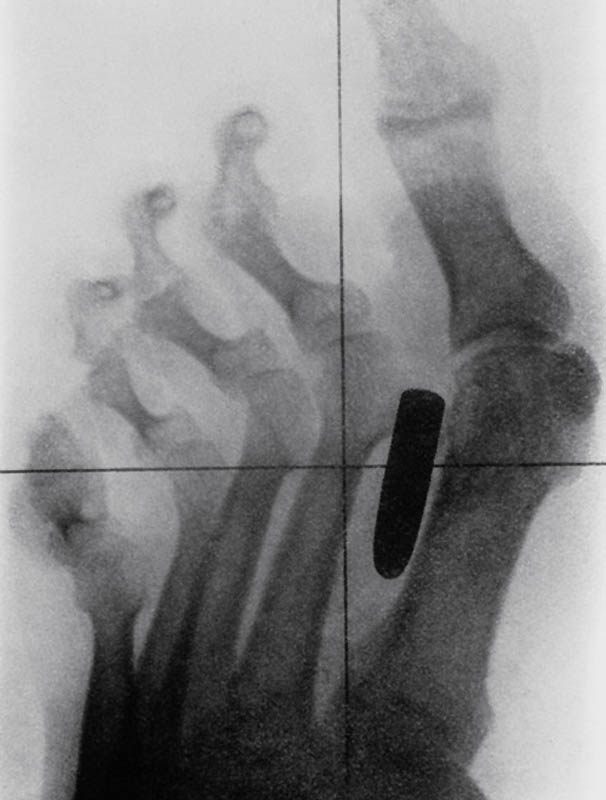 Самые странные рентгеновские снимки