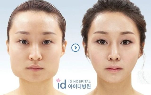 Корейские пластические хирурги